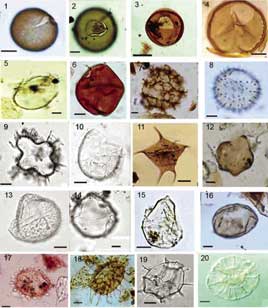 Light microscope photographs of various ecologically diagnostic dinocysts in the Black Sea corridor.